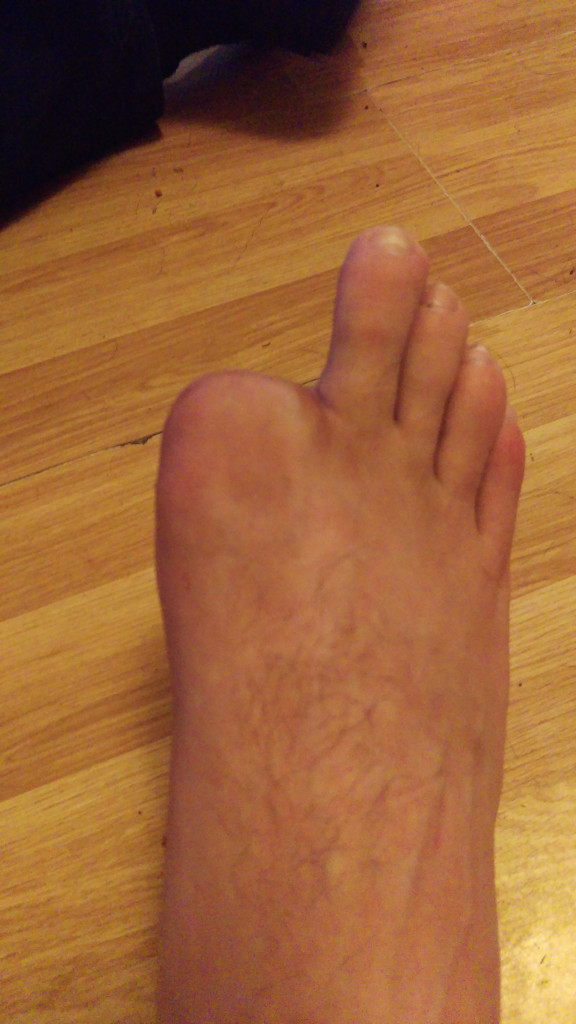 Toe A Little Guy and His Blog